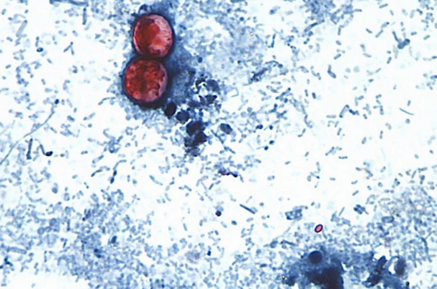 Cyclospora cayetanensis oocysts