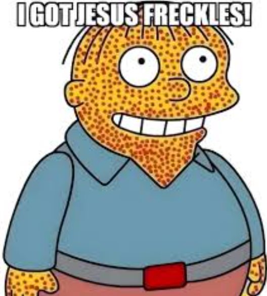 Jesus Freckles are measles