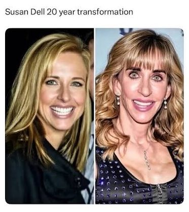 Susan Dell Before After